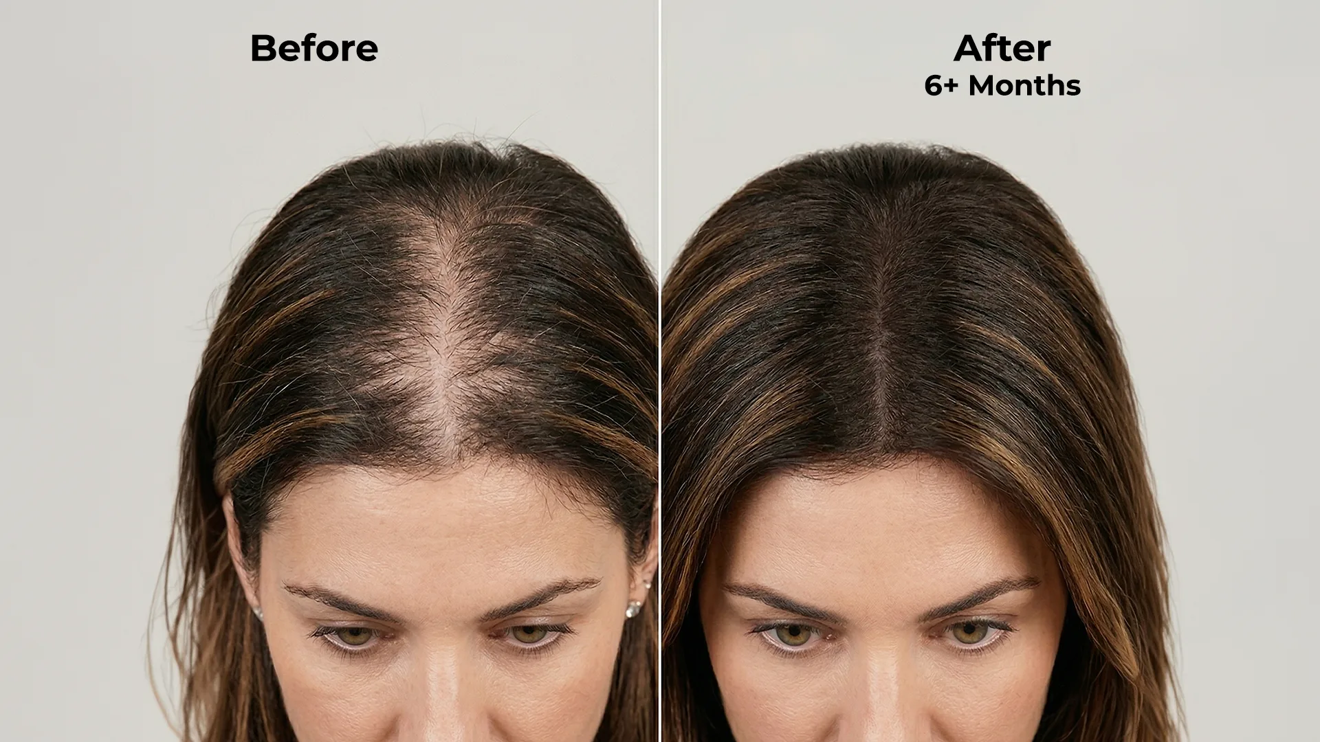 Ghori Derma Roller — The Promise